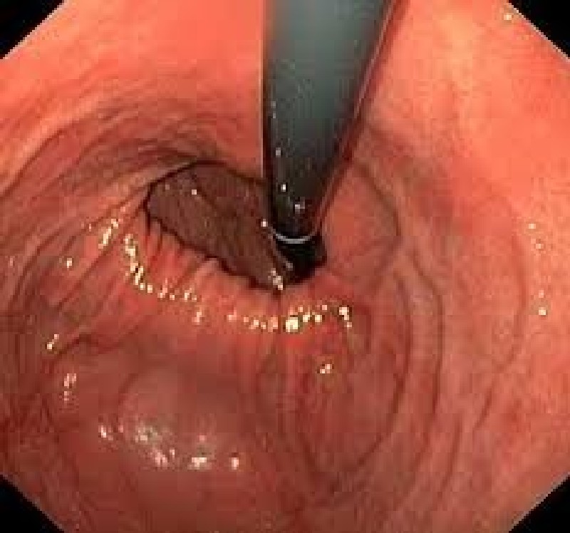 Impressora endoscopia